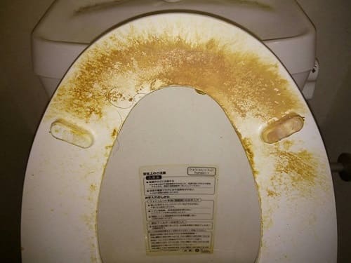 便座の施工前写真